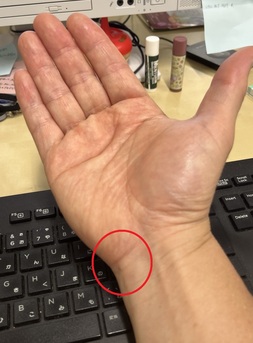 手首が痛い　01